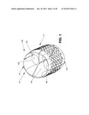 EXPANDABLE SUPPORTIVE ENDOLUMINAL STENT GRAFT diagram and image