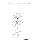 EXPANDABLE SUPPORTIVE ENDOLUMINAL STENT GRAFT diagram and image