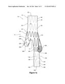 ENDOVASCULAR GRAFT WITH AN EXPANDED LUMEN AT A BIFURCATION diagram and image