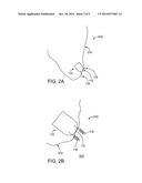 Delivery System with Pacing Element diagram and image