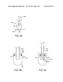 Delivery System with Pacing Element diagram and image