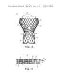 TRANSCATHETER PROSTHETIC HEART VALVE DELIVERY DEVICE WITH BIASED RELEASE     FEATURES diagram and image