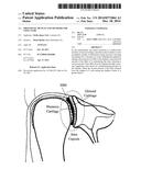 PROSTHETIC DEVICES AND METHODS FOR USING SAME diagram and image