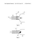 PROSTHETIC DEVICES AND METHODS FOR USING SAME diagram and image