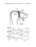 PROSTHETIC DEVICES AND METHODS FOR USING SAME diagram and image