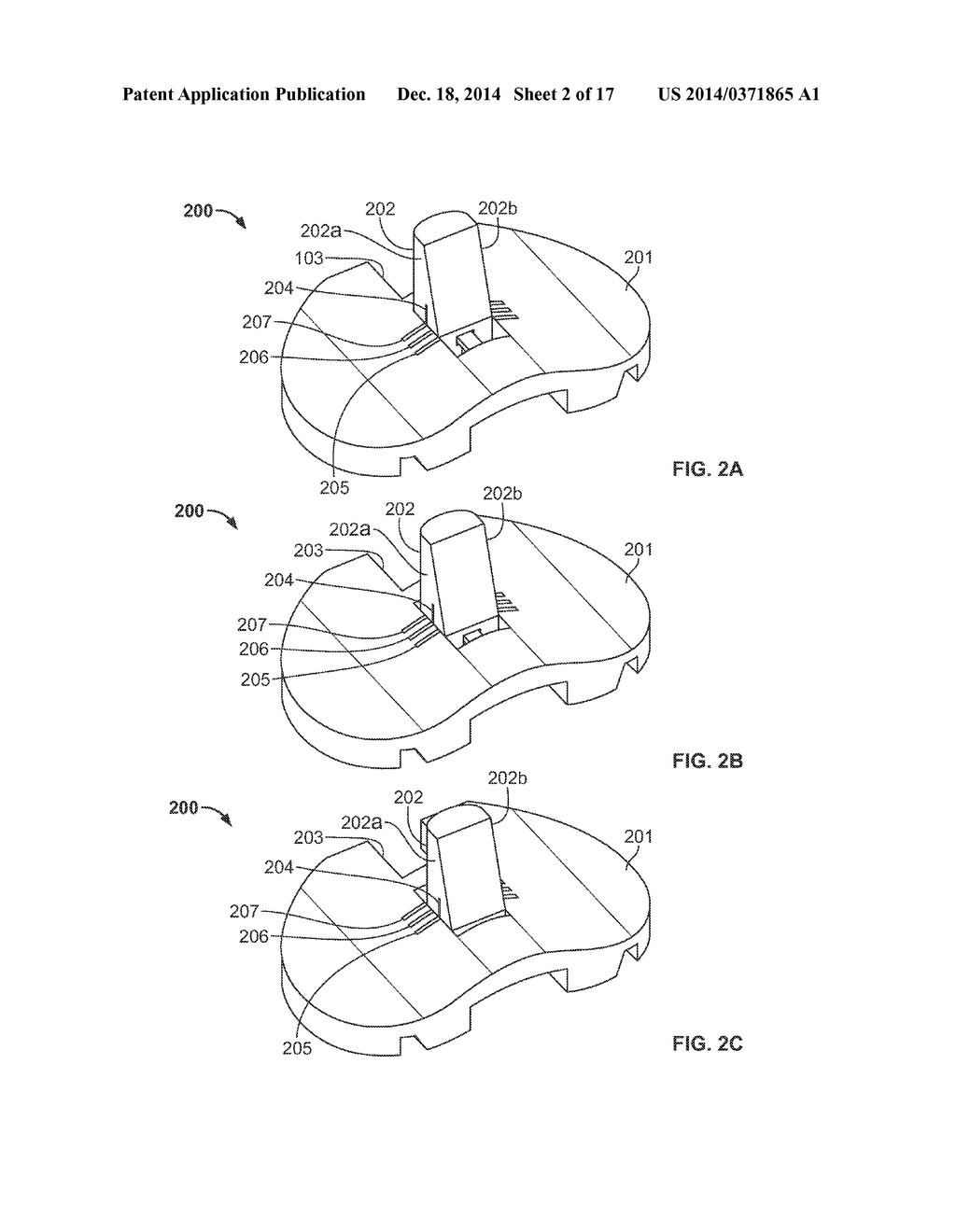 POSTERIOR STABILIZED INSERT TRIAL WITH ADJUSTABLE POST - diagram, schematic, and image 03