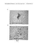 FUMARYLACETOACETATE HYDROLASE (FAH)-DEFICIENT AND IMMUNODEFICIENT RATS AND     USES THEREOF diagram and image