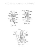 HOLD DOWN DEVICE FOR WINDOW COVERING LOOPED OPERATOR diagram and image