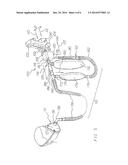 RESPIRATORY FACE MASK AND BREATHING CIRCUIT ASSEMBLY diagram and image