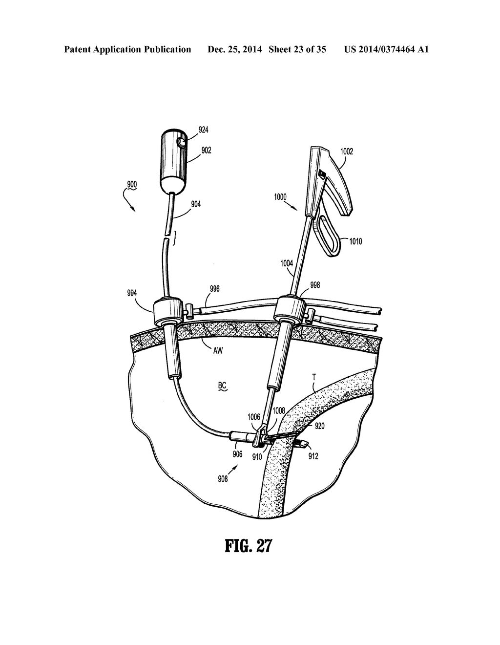 FLEXIBLE SURGICAL STAPLER WITH MOTOR IN THE HEAD - diagram, schematic, and image 24