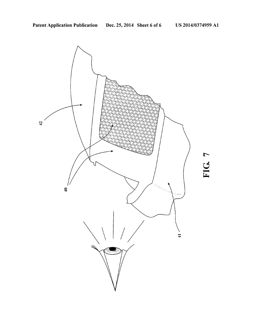 INJECTION MOLDING METHOD WITH INFRARED PREHEAT - diagram, schematic, and image 07