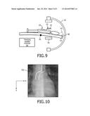 INTRA-OPERATIVE QUALITY MONITORING OF TRACKING SYSTEMS diagram and image