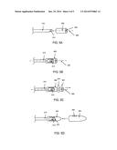 METHODS AND APPARATUS RELATED TO A SIDE-FIRE MEMBER HAVING A DOPED SILICA     COMPONENT diagram and image