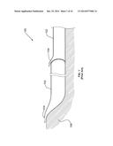 FLUID FILLABLE STRUCTURE diagram and image