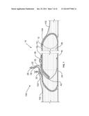 FLUID FILLABLE STRUCTURE diagram and image