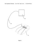 FLUID FILLABLE STRUCTURE diagram and image