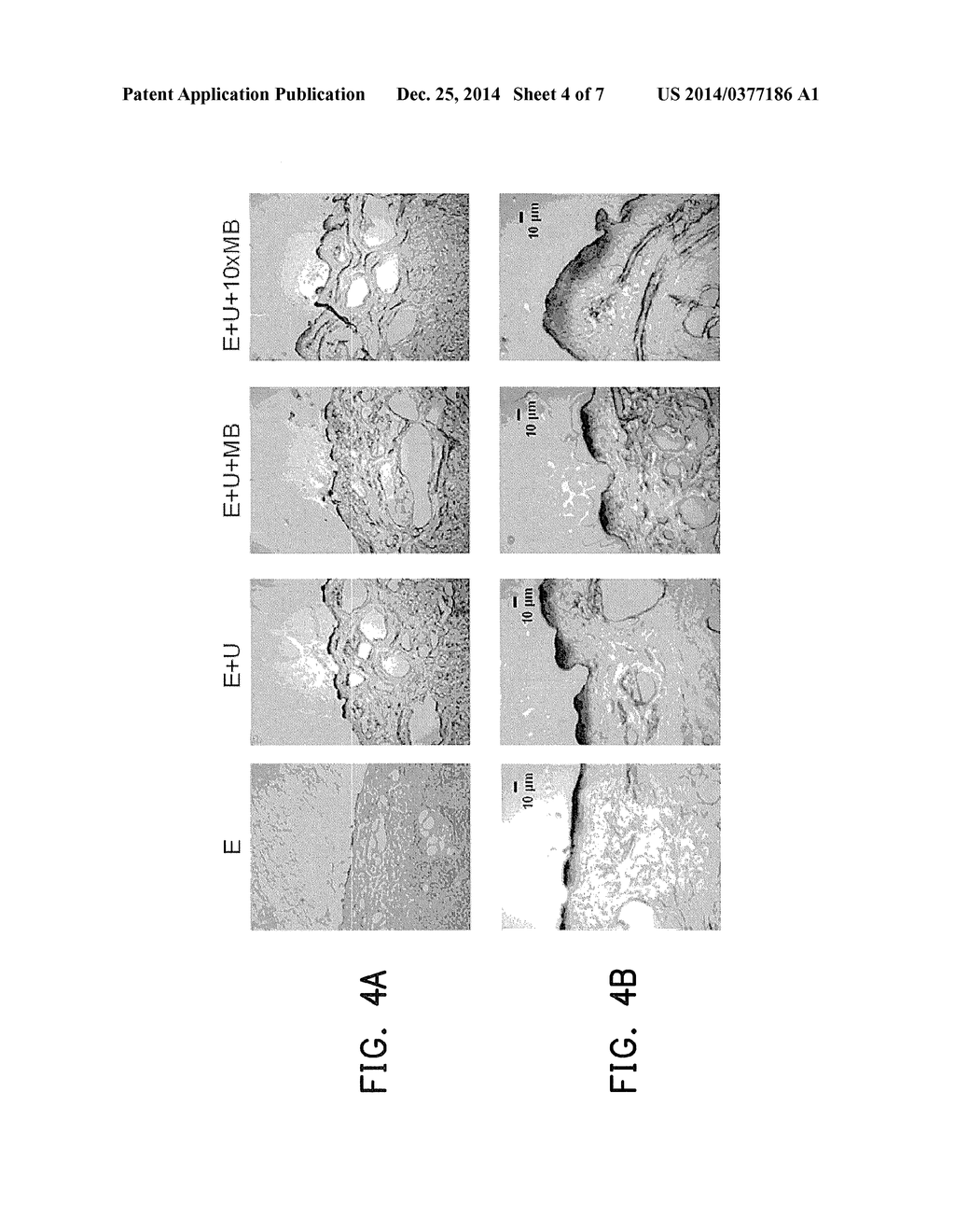 MICROBUBBLE ULTRASOUND CONTRAST AGENT FOR EXTERNAL USE - diagram, schematic, and image 05