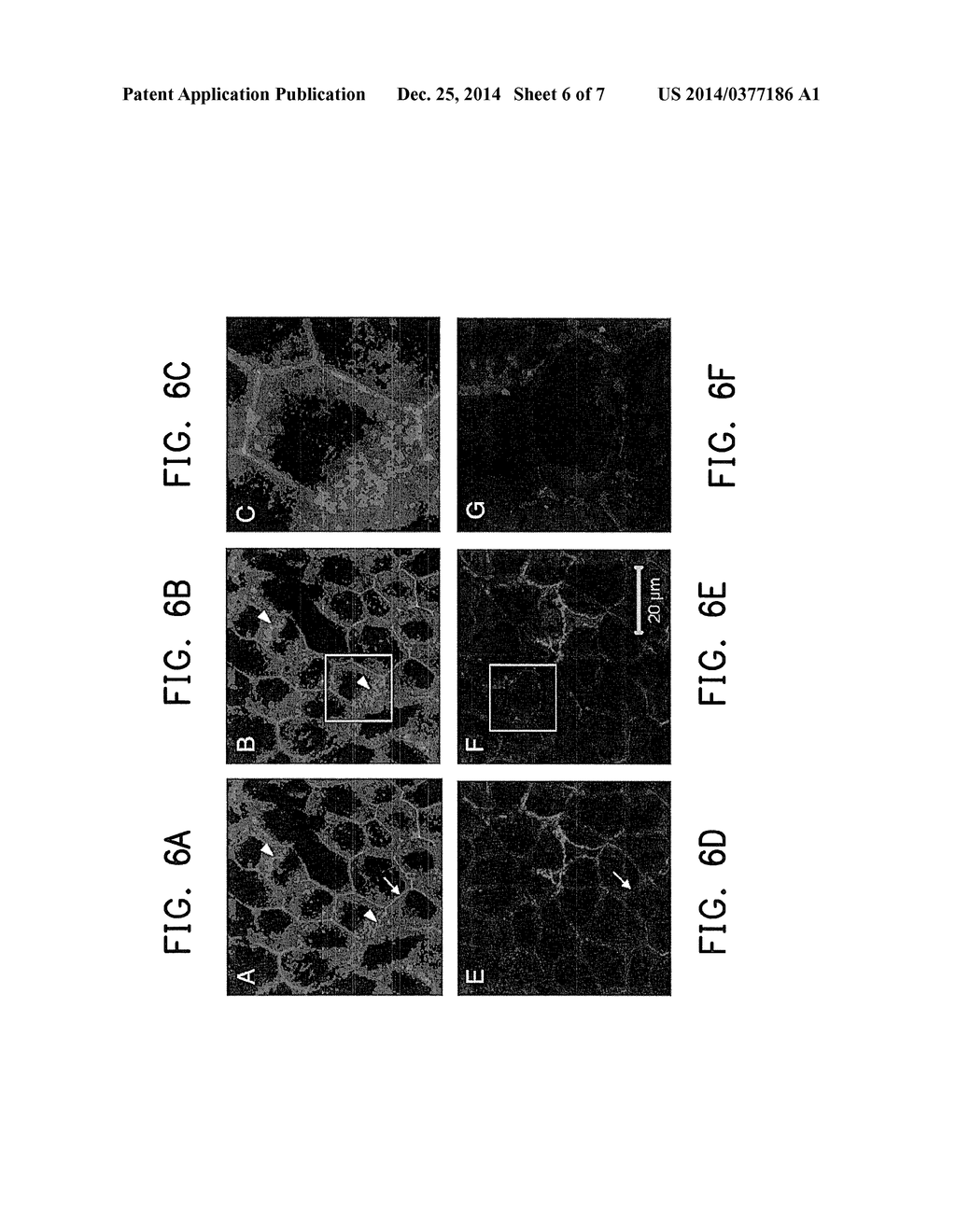 MICROBUBBLE ULTRASOUND CONTRAST AGENT FOR EXTERNAL USE - diagram, schematic, and image 07