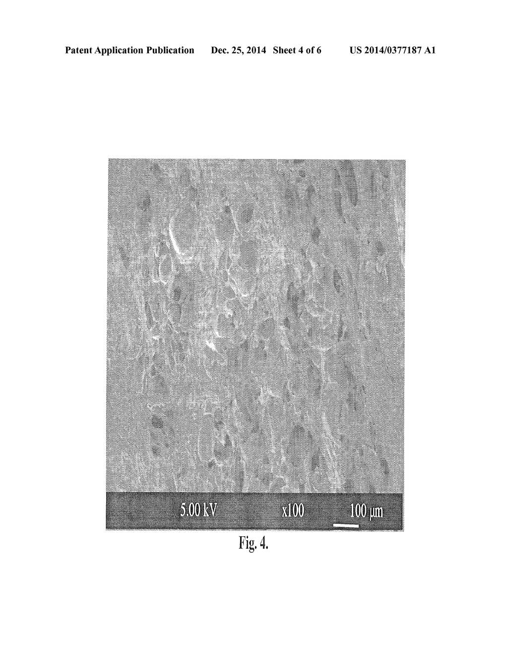 Embolizing Sclerosing Hydrogel - diagram, schematic, and image 05