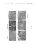 USE OF INTERLEUKIN-22 IN THE TREATMENT OF FATTY LIVER DISEASE diagram and image