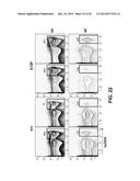 METHODS OF EXPANDING MYELOID CELL POPULATIONS AND USES THEREOF diagram and image