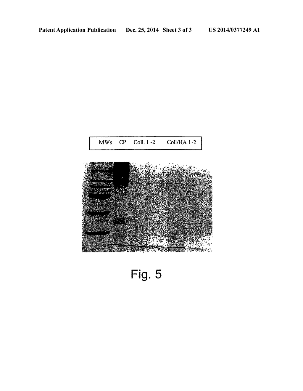 NEW PHARMACEUTICAL COMPOSITIONS CONTAINING HYALURONIC ACID AND COLLAGENASE     FOR THE TOPICAL TREATMENT OF WOUNDS, BURNS AND ULCERS - diagram, schematic, and image 04