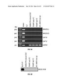 Methods and Compositions Involving NKG2D Inhibitors and Cancer diagram and image