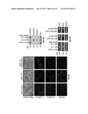 Methods and Compositions Involving NKG2D Inhibitors and Cancer diagram and image