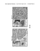 Methods and Compositions Involving NKG2D Inhibitors and Cancer diagram and image