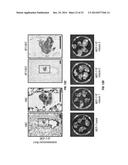 Methods and Compositions Involving NKG2D Inhibitors and Cancer diagram and image