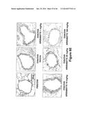 METHODS TO TREAT ALLERGIC CONDITIONS diagram and image