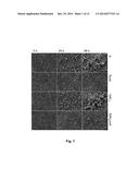 MEDICAL DEVICE COMPRISING COLLAGEN-VI diagram and image