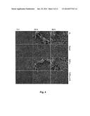 MEDICAL DEVICE COMPRISING COLLAGEN-VI diagram and image