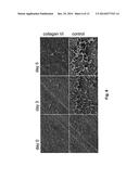 MEDICAL DEVICE COMPRISING COLLAGEN-VI diagram and image