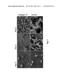 MEDICAL DEVICE COMPRISING COLLAGEN-VI diagram and image