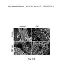 MEDICAL DEVICE COMPRISING COLLAGEN-VI diagram and image