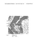 SMALL SPECIMEN STAINING AND DIAGNOSING OF CELLS diagram and image