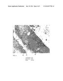 SMALL SPECIMEN STAINING AND DIAGNOSING OF CELLS diagram and image