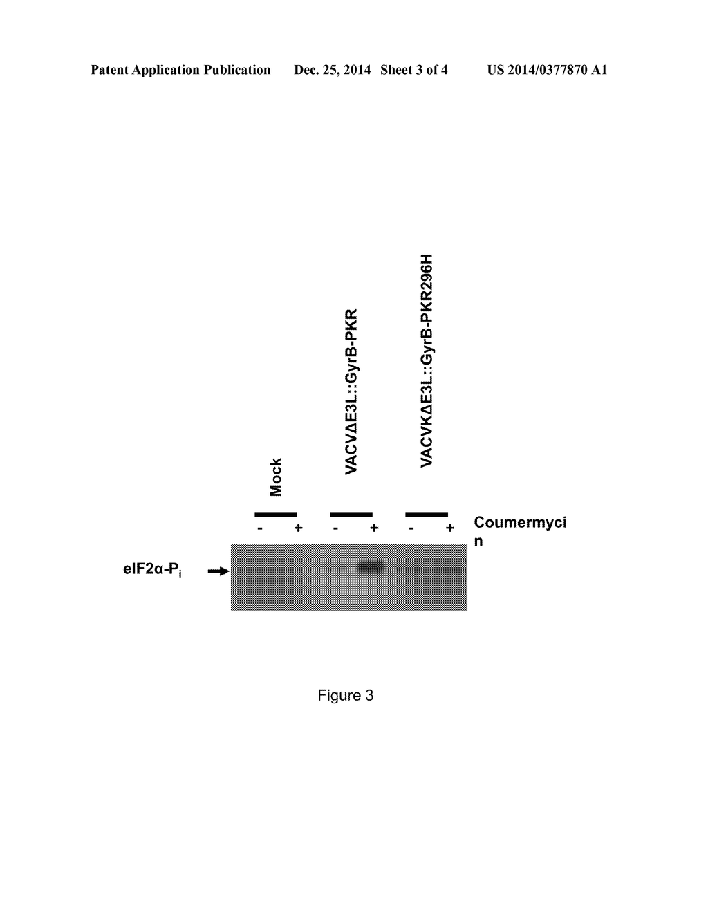 METHOD FOR INSERTING GENETIC MATERIAL INTO GENOMIC DNA - diagram, schematic, and image 04