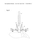 DEBONING SYSTEM AND DEBONING METHOD FOR ARM PART OF BONE-IN MEAT diagram and image