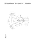 UTERINE LAVAGE FOR EMBRYO RETRIEVAL diagram and image