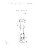 UTERINE LAVAGE FOR EMBRYO RETRIEVAL diagram and image