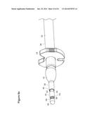 UTERINE LAVAGE FOR EMBRYO RETRIEVAL diagram and image