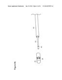 UTERINE LAVAGE FOR EMBRYO RETRIEVAL diagram and image