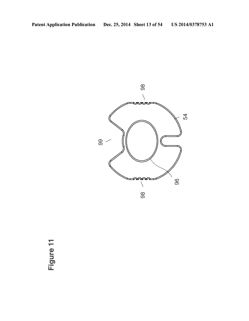 UTERINE LAVAGE FOR EMBRYO RETRIEVAL - diagram, schematic, and image 14