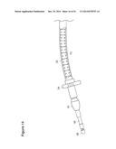 UTERINE LAVAGE FOR EMBRYO RETRIEVAL diagram and image