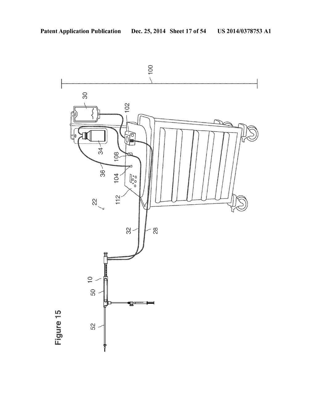 UTERINE LAVAGE FOR EMBRYO RETRIEVAL - diagram, schematic, and image 18