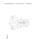 UTERINE LAVAGE FOR EMBRYO RETRIEVAL diagram and image