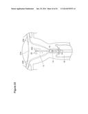 UTERINE LAVAGE FOR EMBRYO RETRIEVAL diagram and image