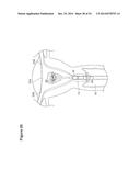 UTERINE LAVAGE FOR EMBRYO RETRIEVAL diagram and image